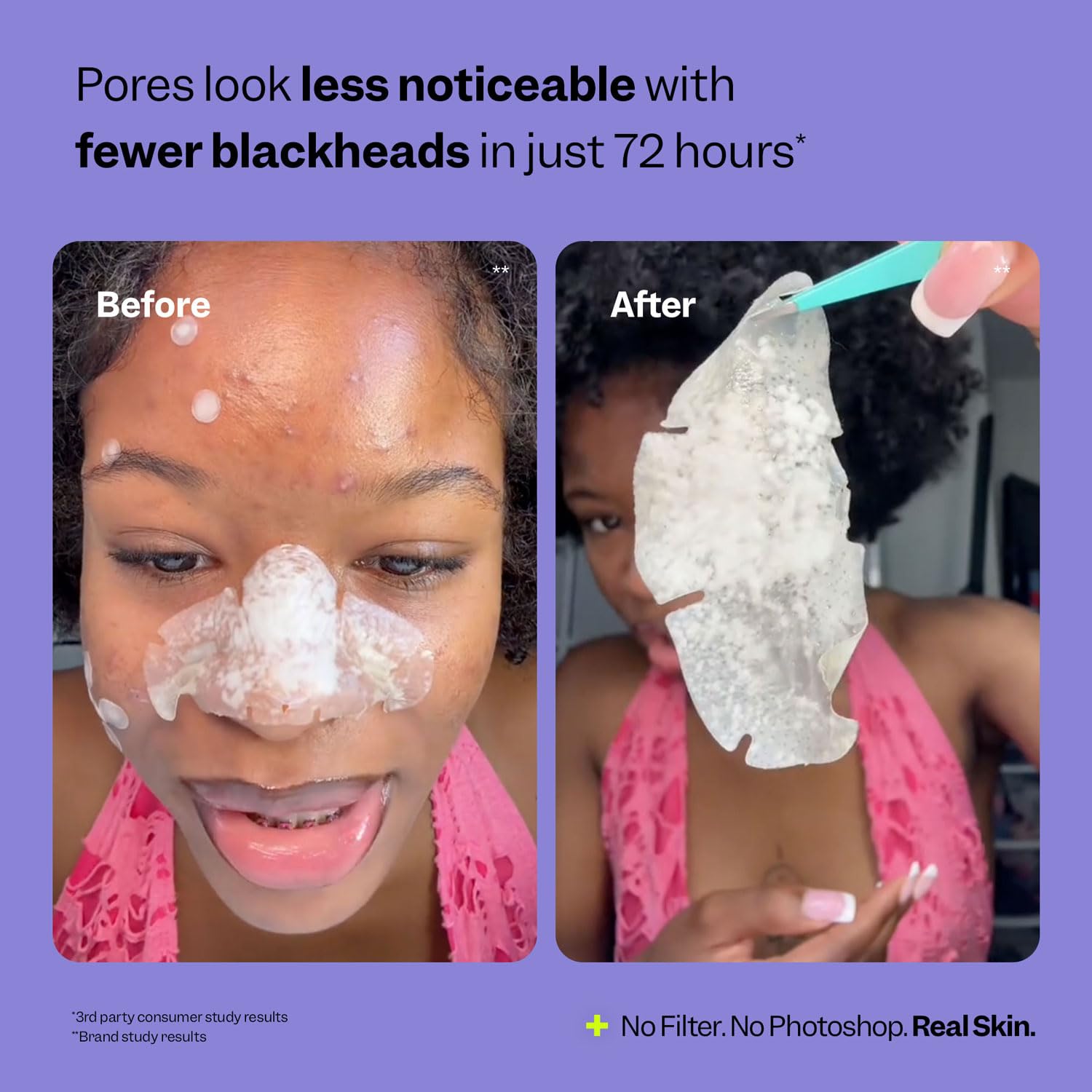 Peach Slices Nose Pore Patches K-beauty