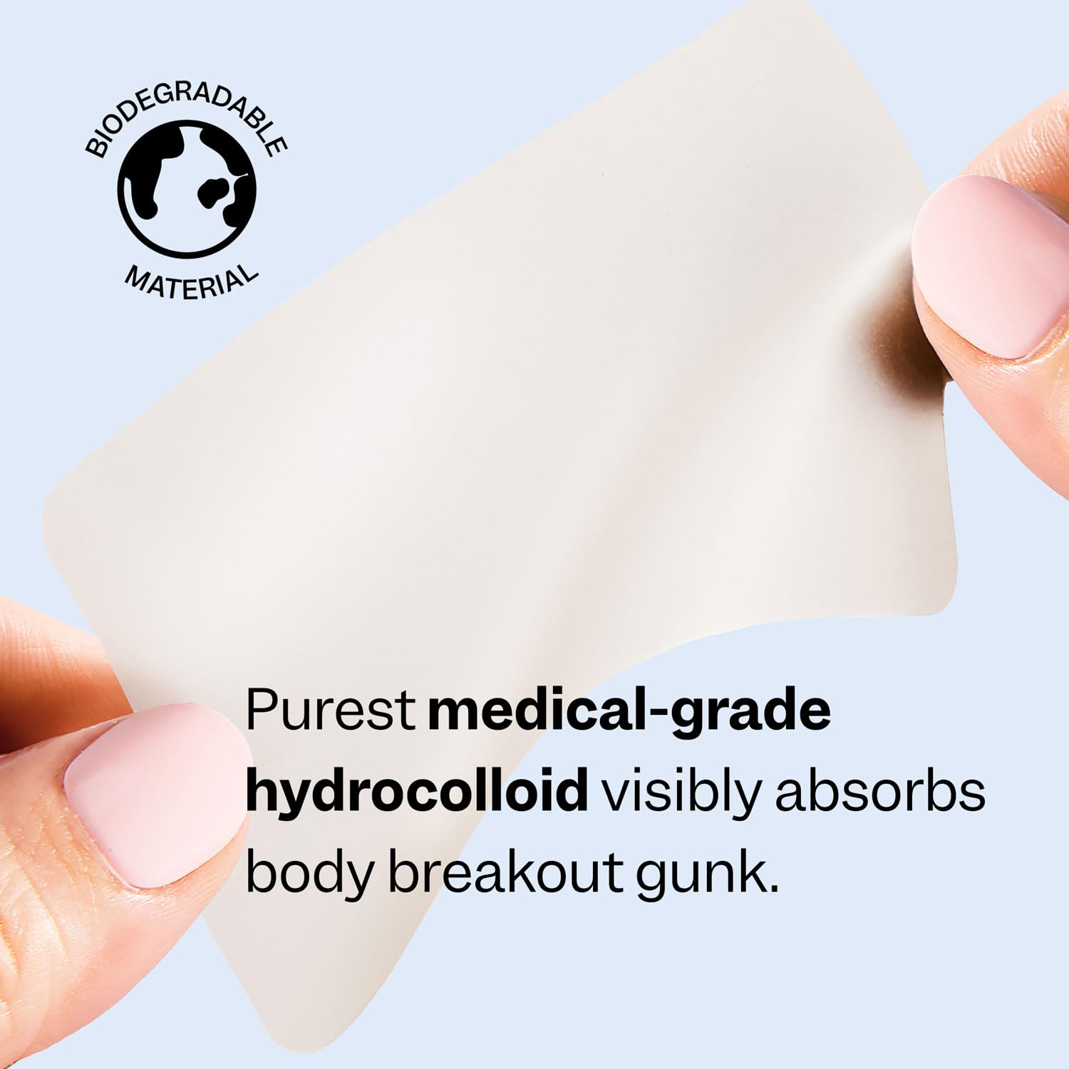 Oversized hydrocolloid patch targets larger breakout clusters