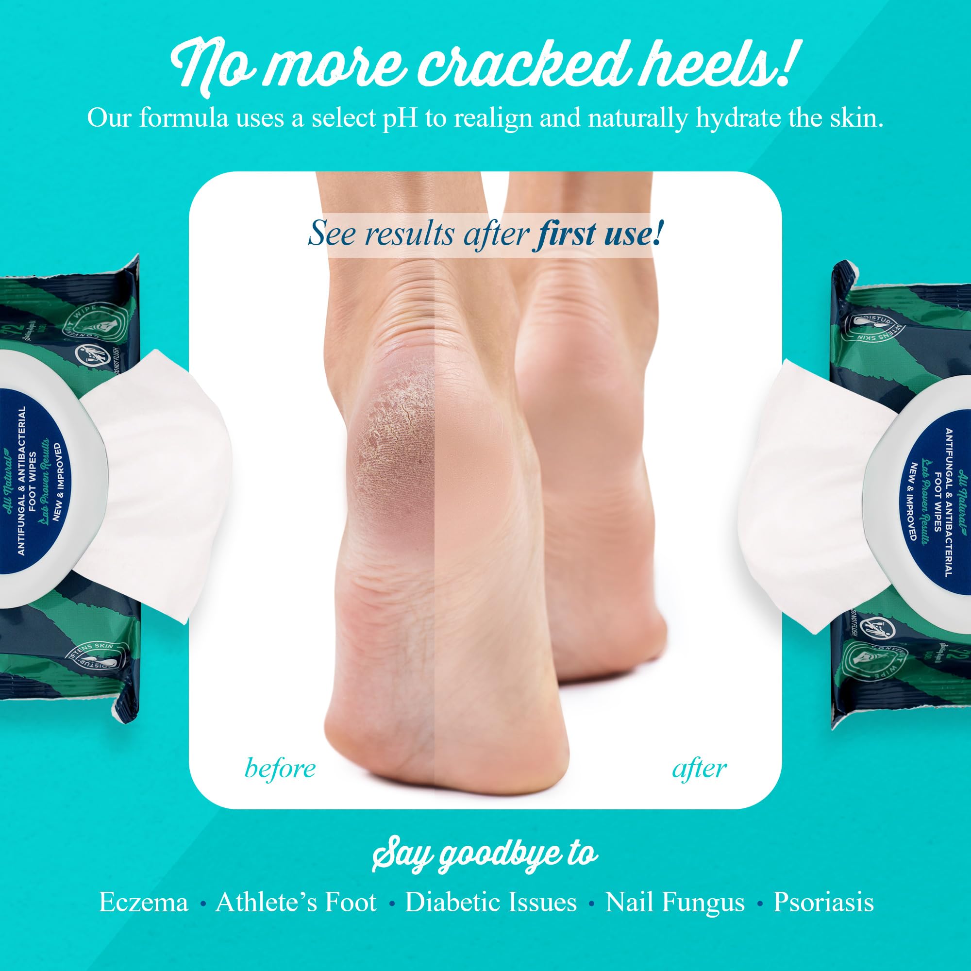 pHeet on-the-go portable foot wipes