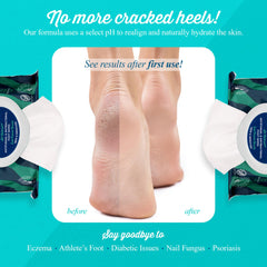 pHeet on-the-go portable foot wipes