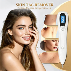Portable CTS-15 skin tag remover for travel
