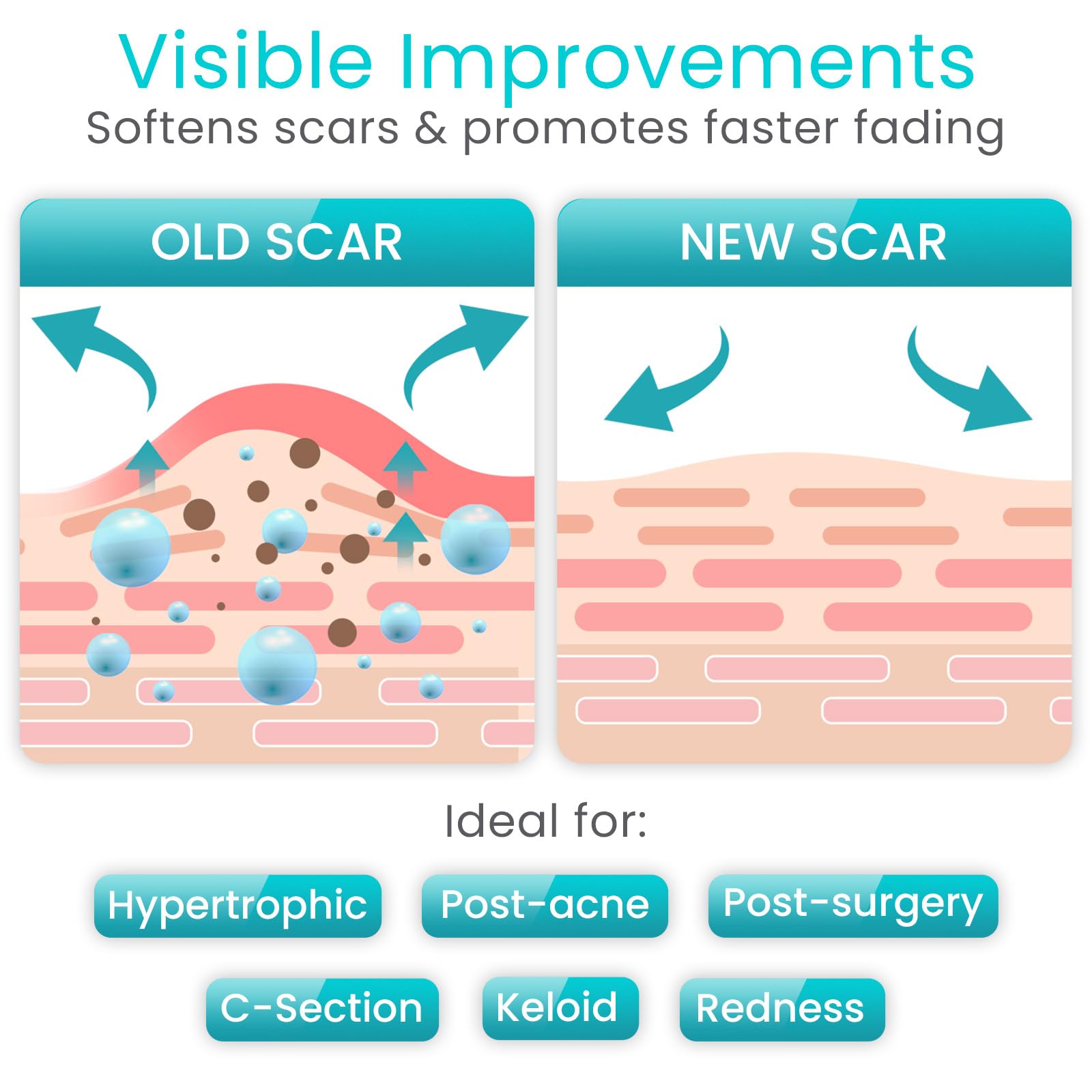 Post-surgery scar tape waterproof protection image