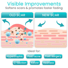 Post-surgery scar tape waterproof protection image