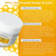 Psoriasis eczema scalp treatment product image