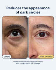 Remedy eye cream ingredients Kojic Niacinamide Hexylresorcinol