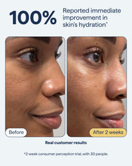 remedy cream quadruple ceramide complex glycerin and squalane ingredients