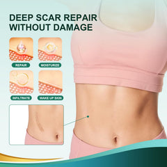 Reusable silicone scar strip for keloid image