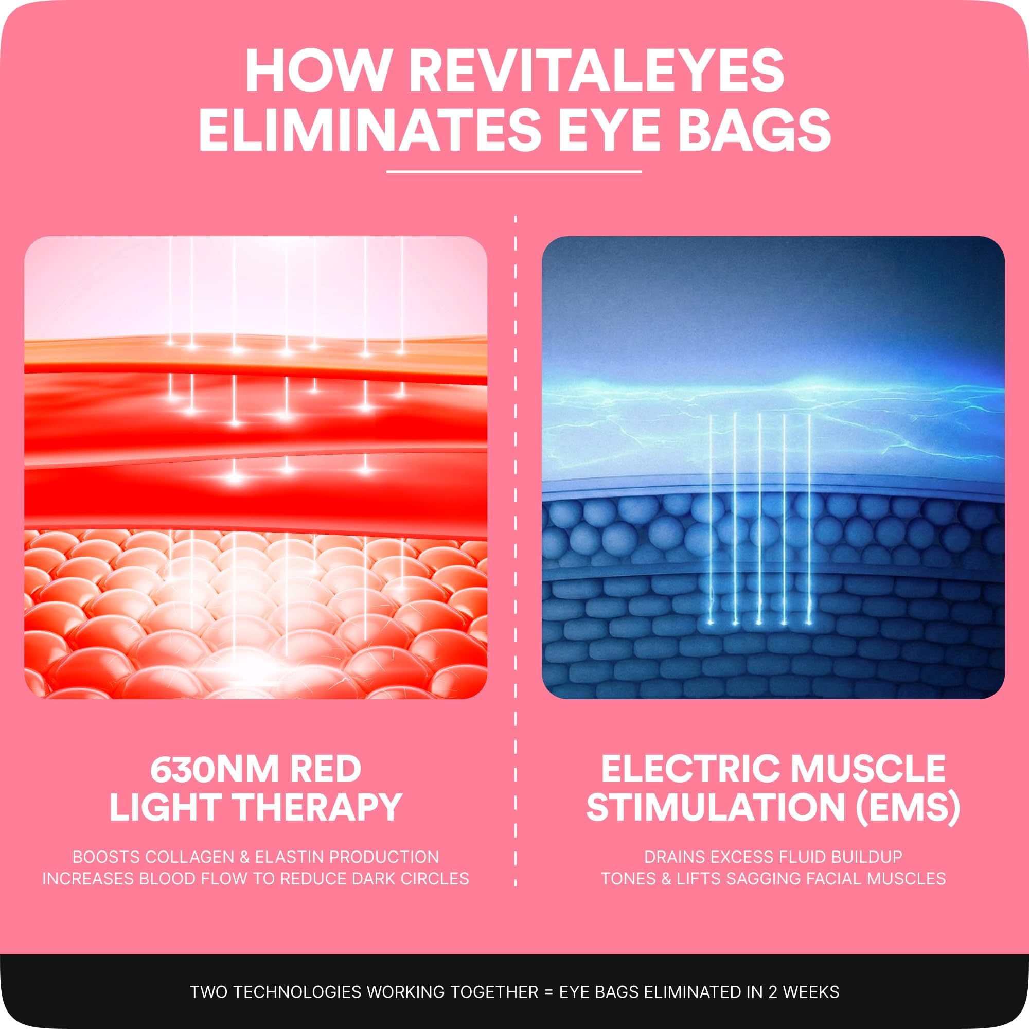 botanique paris revitaleyes-light-based tool image