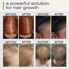 Rosemary castor biotin hair growth oil close up bottle