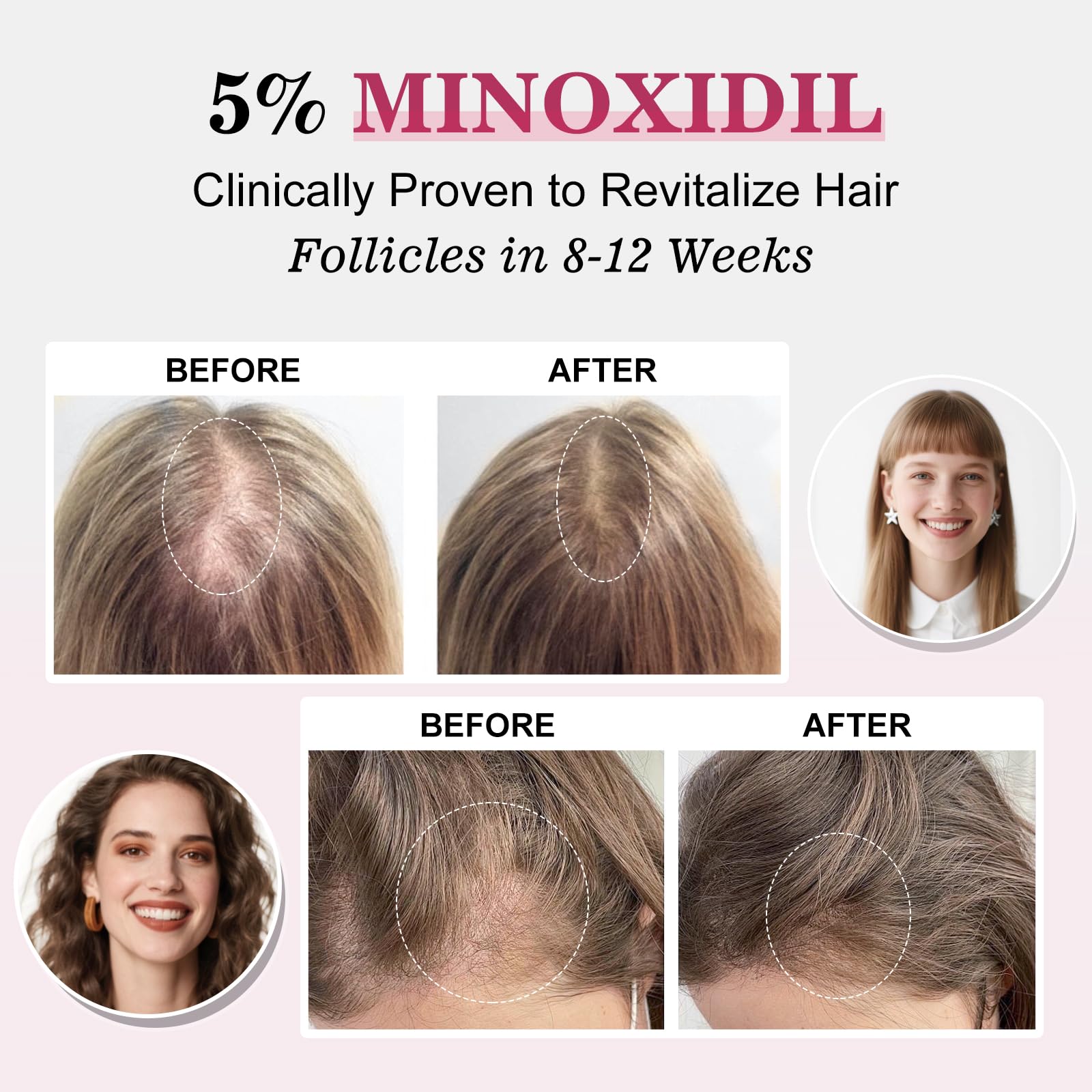 Women’s hair regrowth Minoxidil with applicator and Biotin