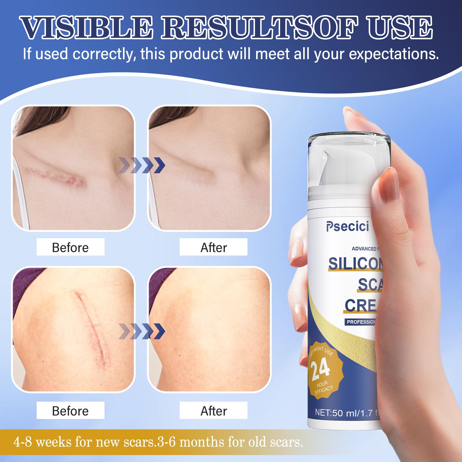 Scar removal cream Psecici for burns acne scars 1.7 oz