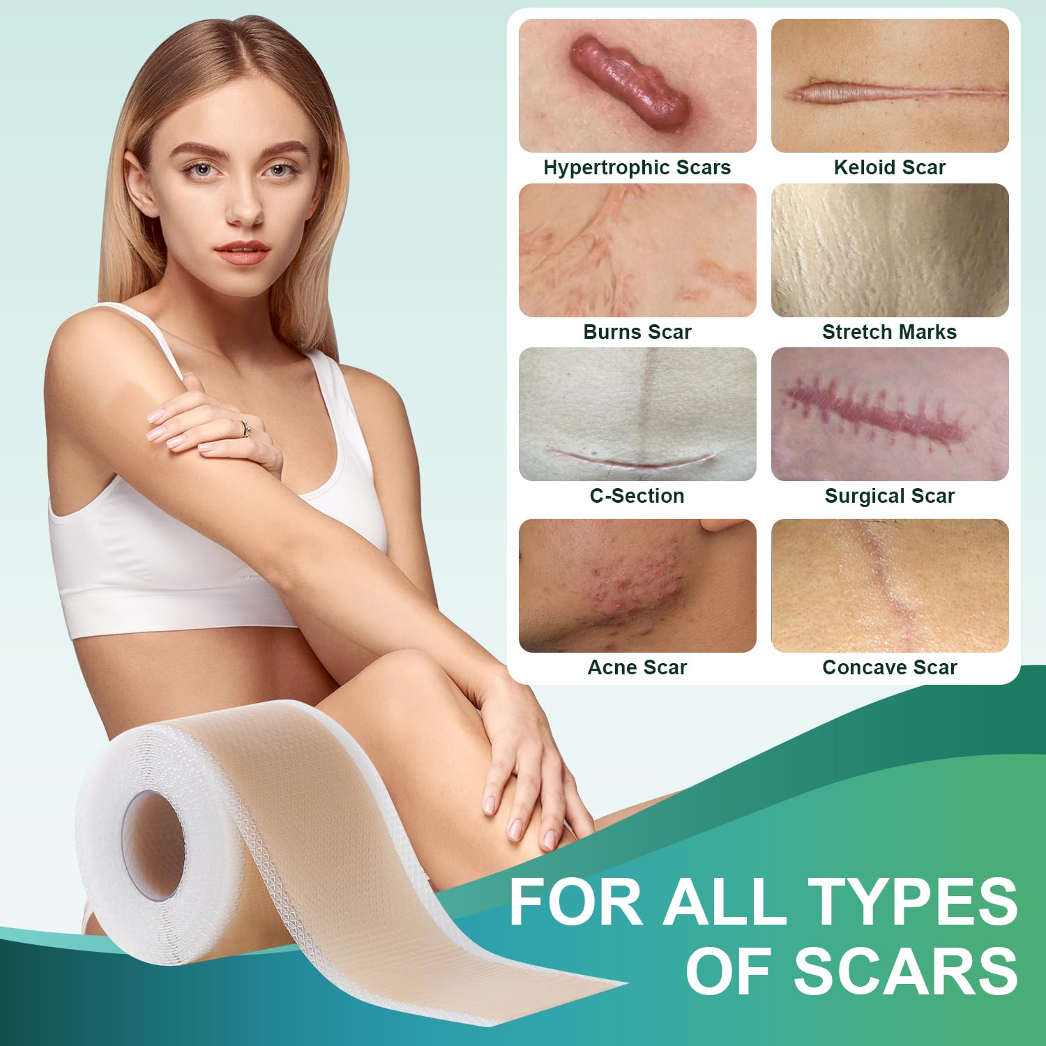 Scar sheets for acne and scars image