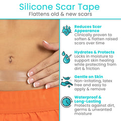 Medical-grade silicone scar tape in use on skin