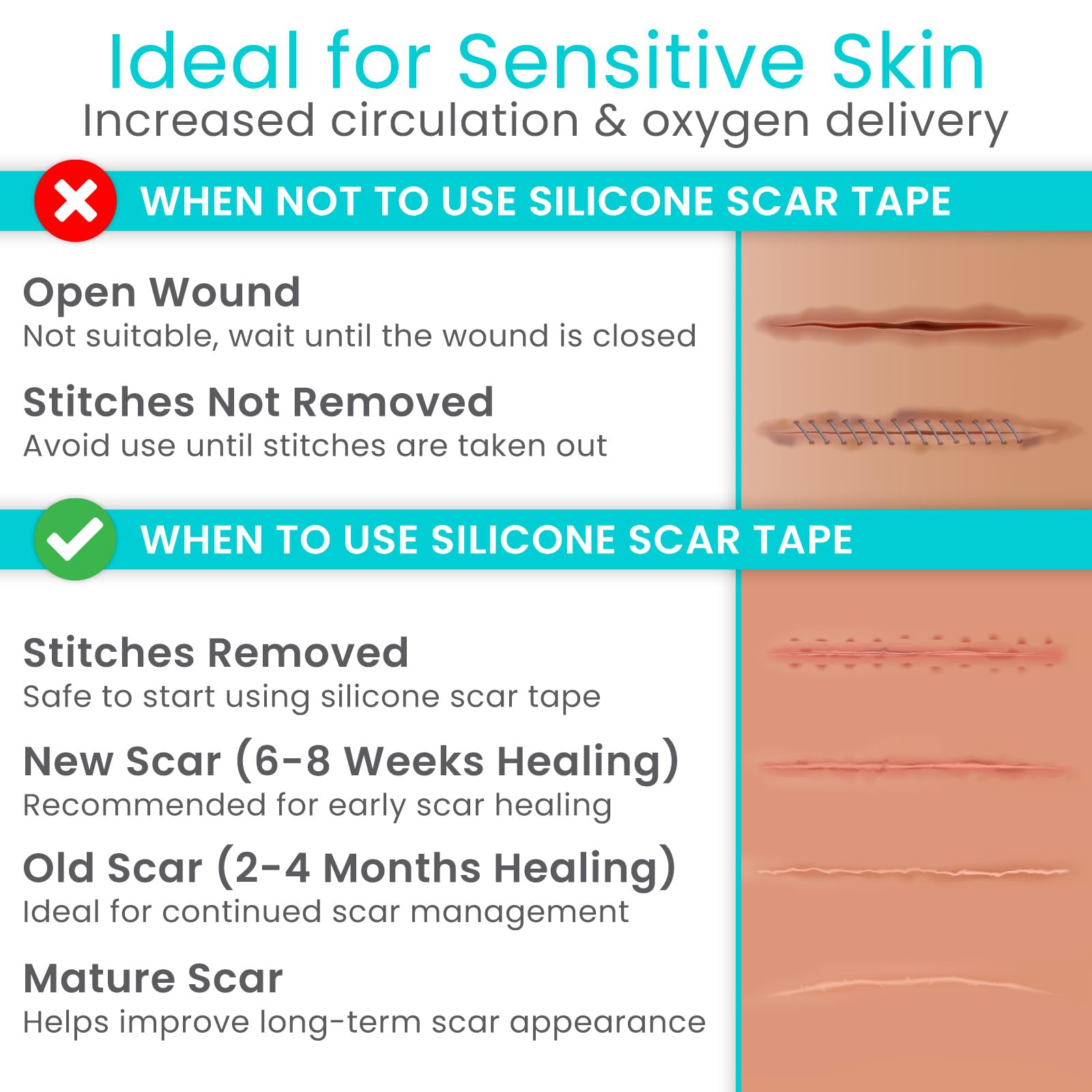Scar tape suitable for cesarean or breast surgery scars