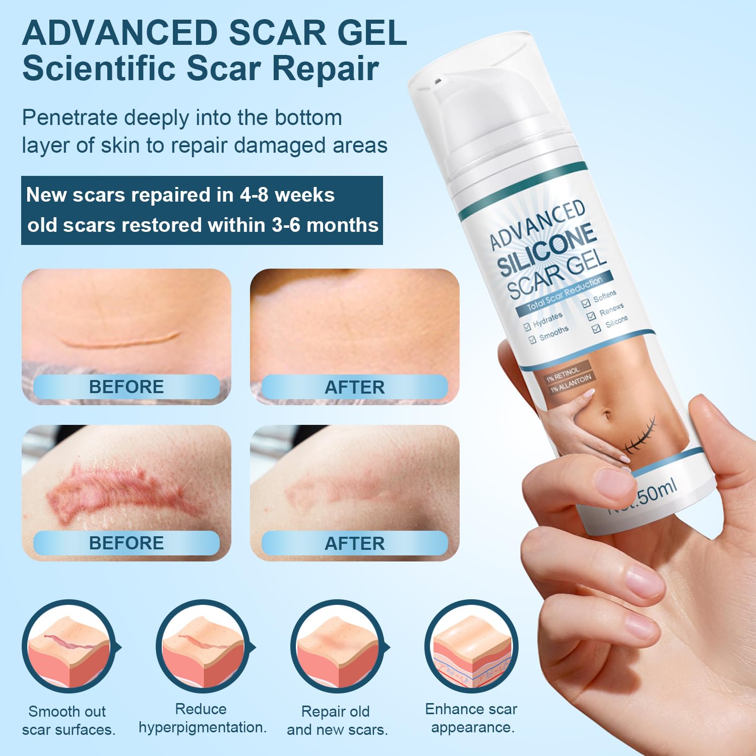 Silicone scar gel used on body and face to address scars