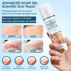 Silicone scar gel used on body and face to address scars