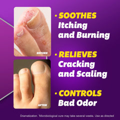 Silka antifungal cream for jock itch treatment