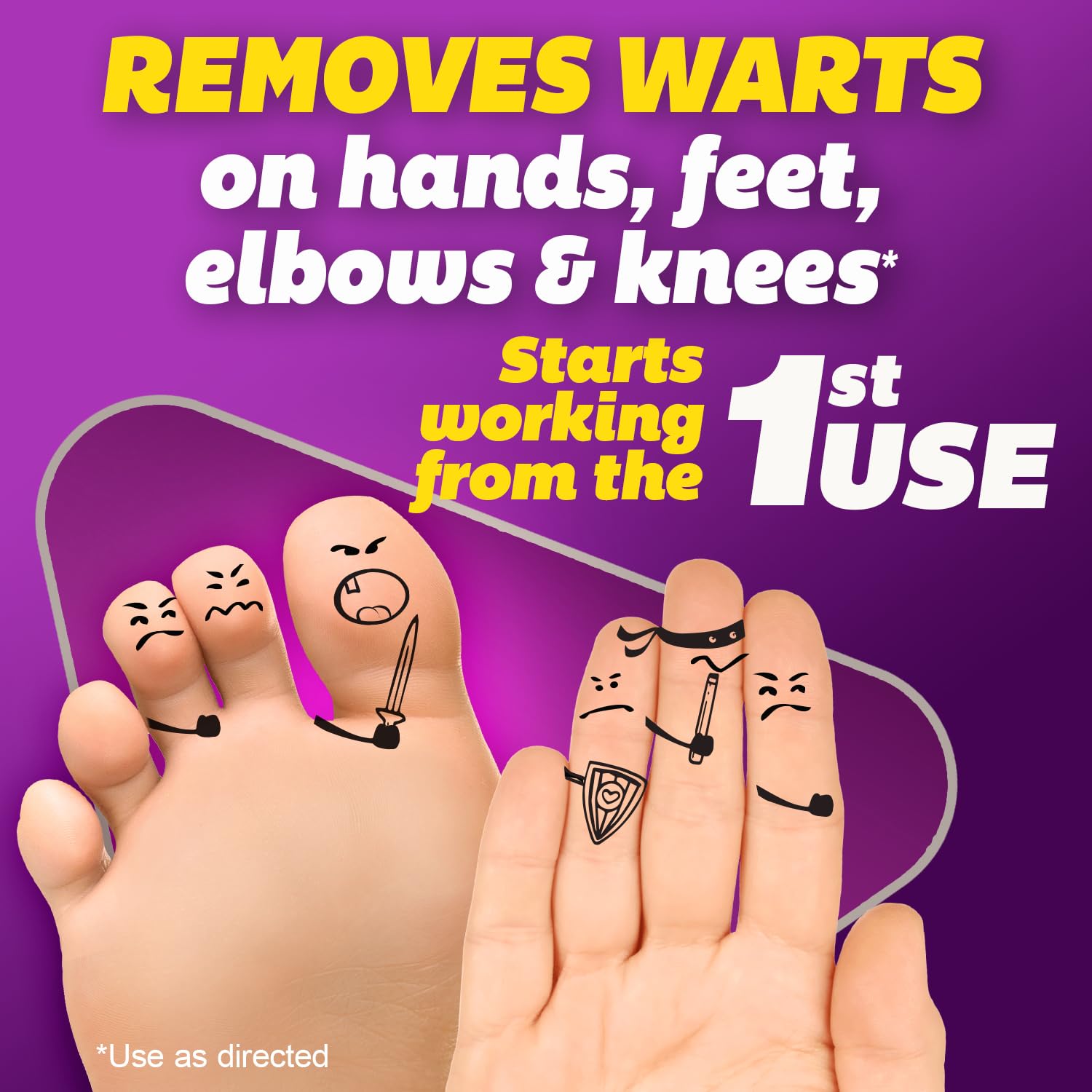Silka Pointts Wart Remover Freeze Off for hands and feet