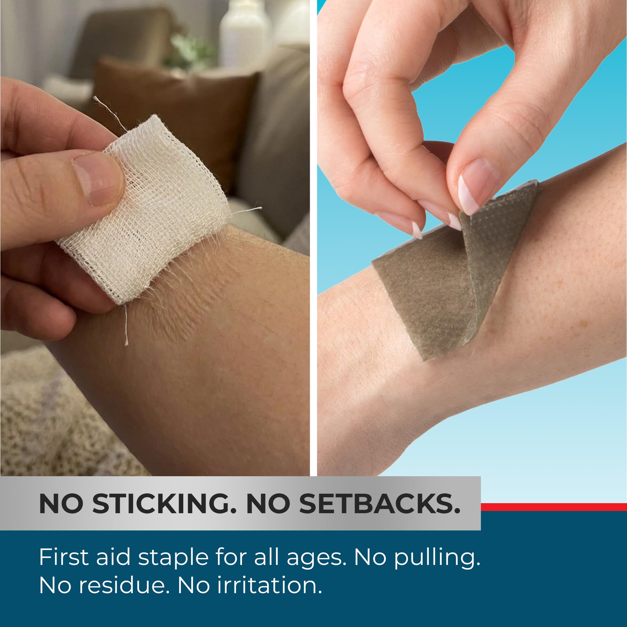 X-Static silver infused hydrogel for burns wounds
