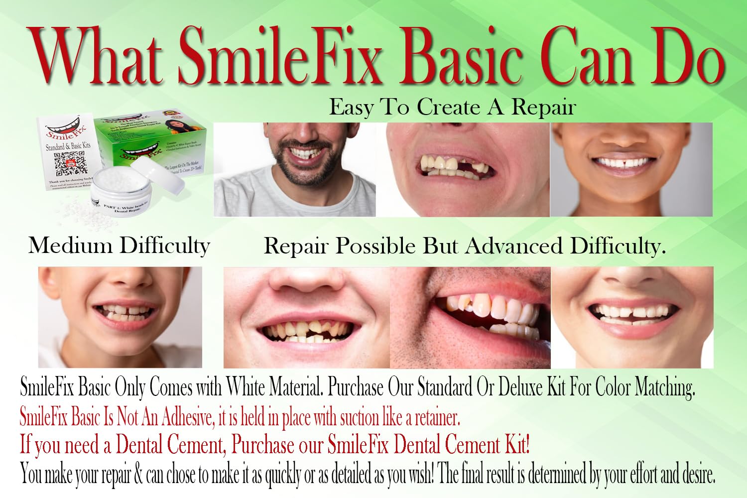 Durable thermoplastic beads for SmileFix Basic Dental Repair