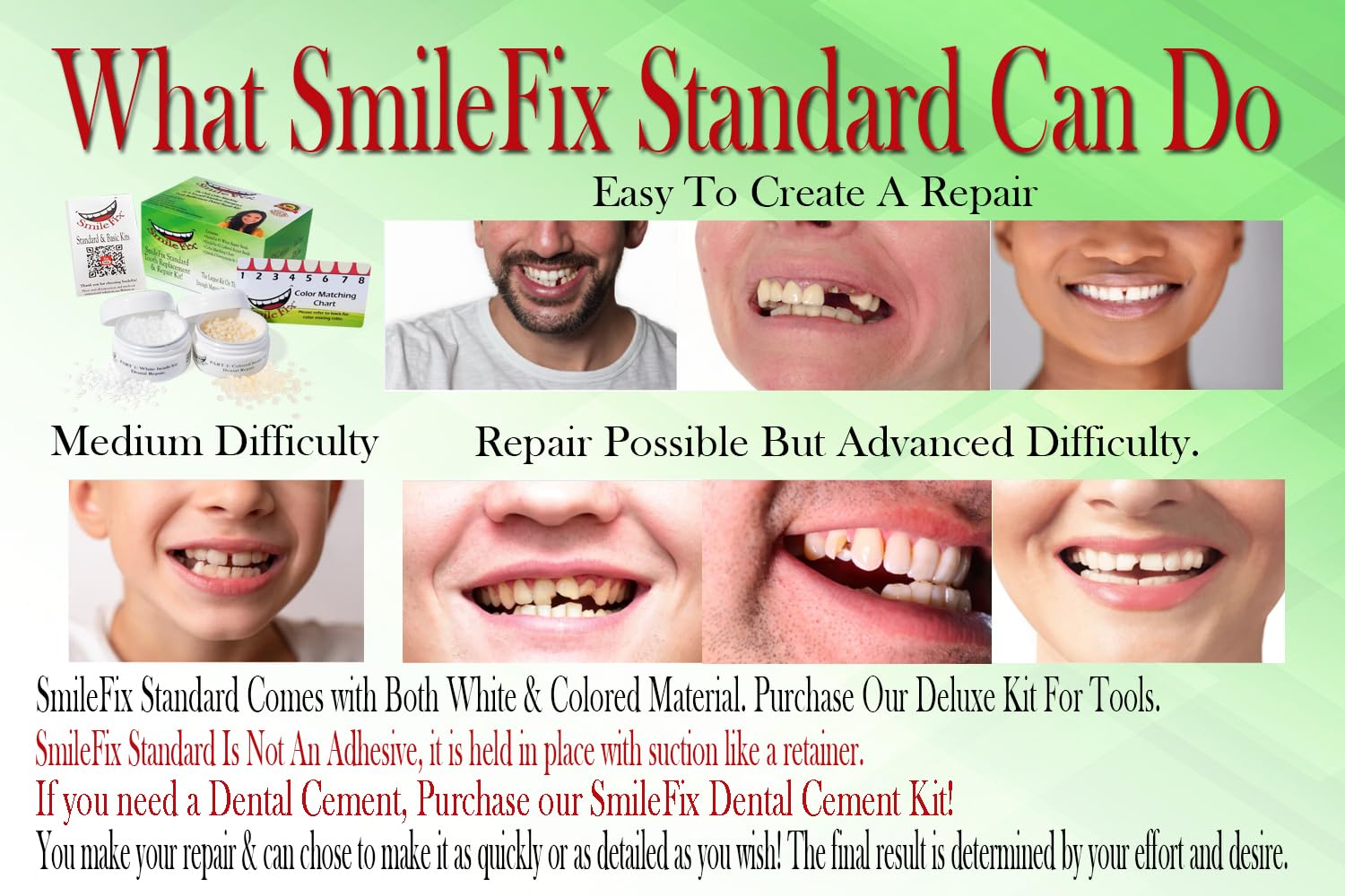 Color matching beads included with SmileFix kit
