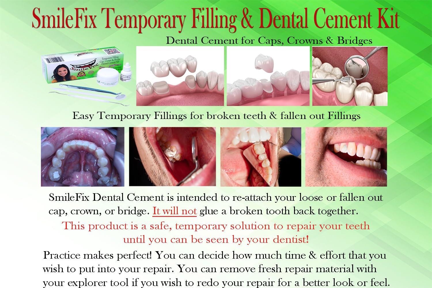 SmileFix at home dental repair kit for crowns bridges fillings