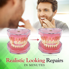 At home dental repair for missing teeth using SmileFix