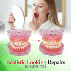 SmileFix kit for missing tooth restoration at home