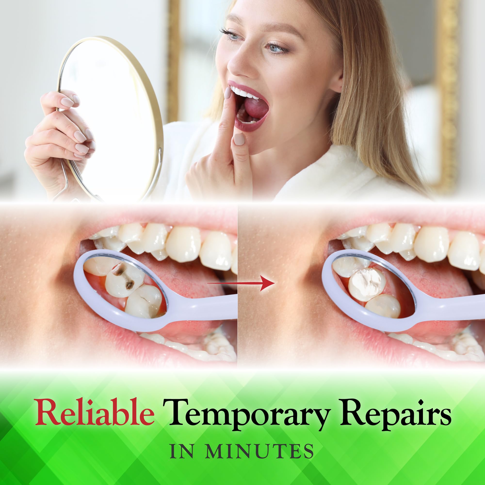 SmileFix dental cement kit used for at home restorations