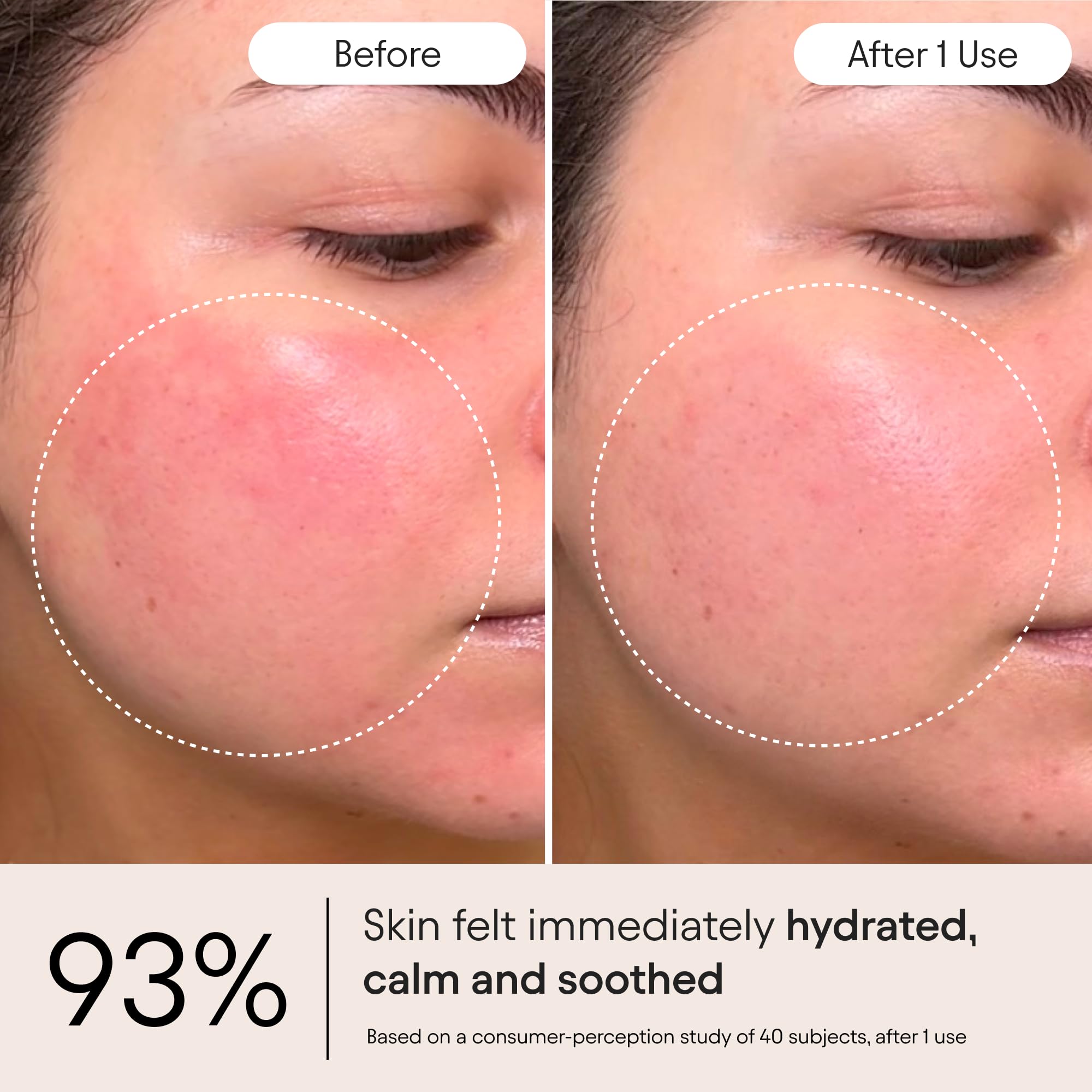 Snap 8 peptide feature in ALPYN cream