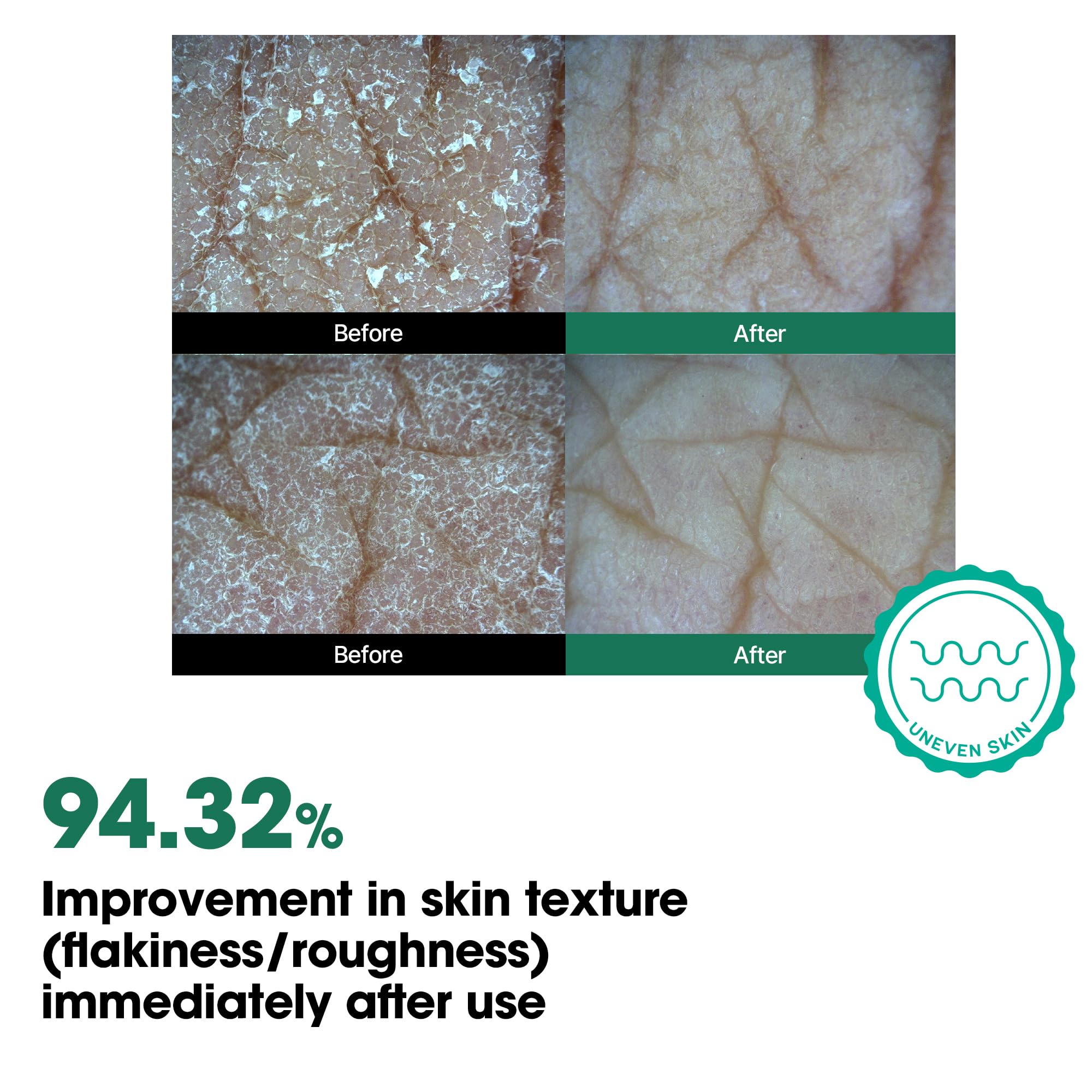 Blemish-prone skin targeted body spray