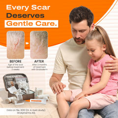 Strataderm Scar Therapy Gel for burns scars