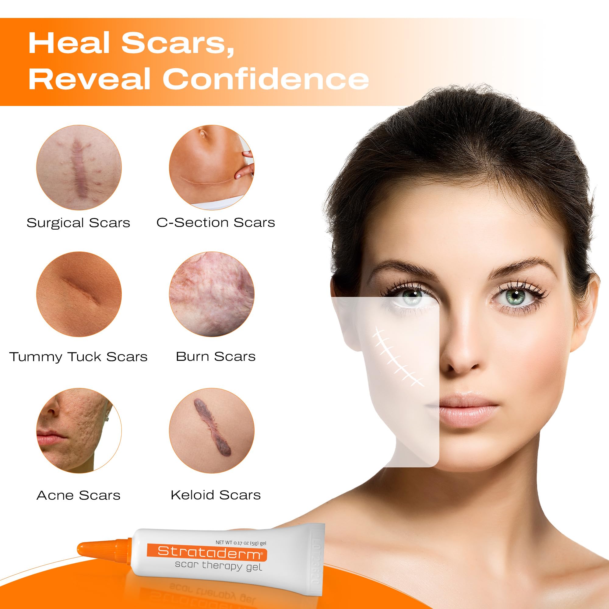 Strataderm Scar Therapy Gel used on surgery scars