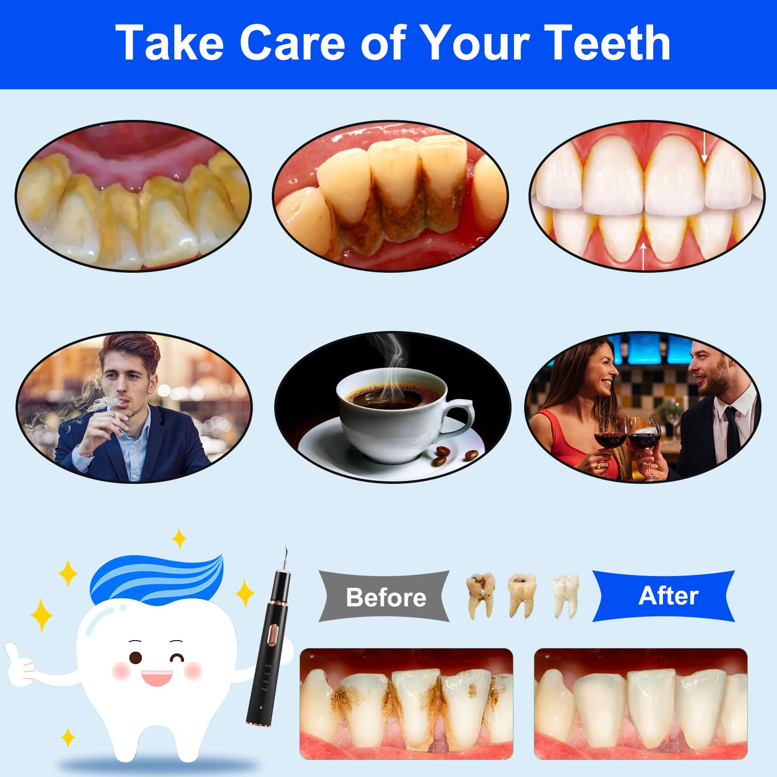 Tartar Remover for Teeth Cleaning tool with two pointed heads
