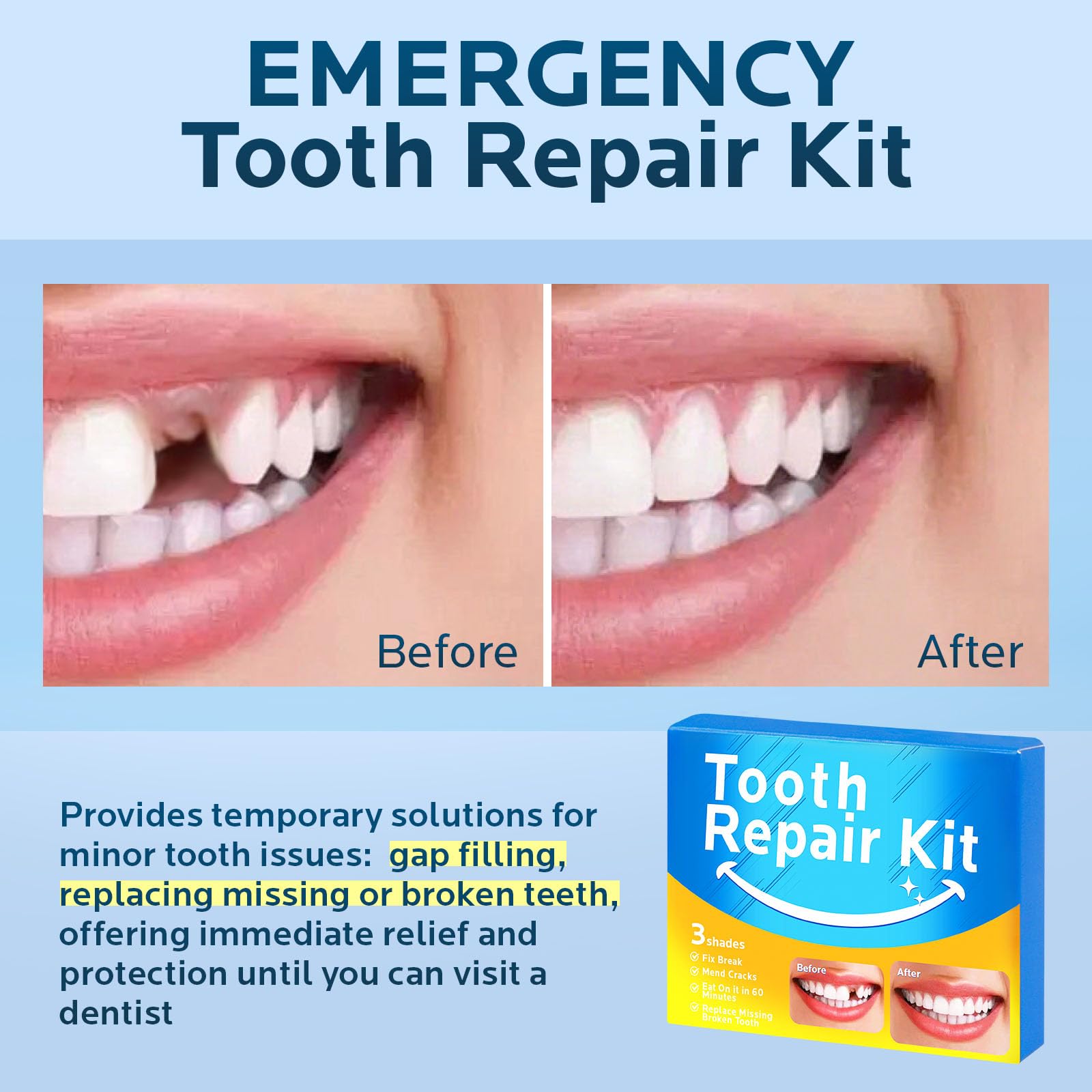 Temporary natural shade for filling tooth gaps illustration