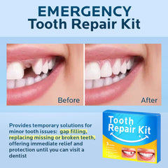 Temporary natural shade for filling tooth gaps illustration