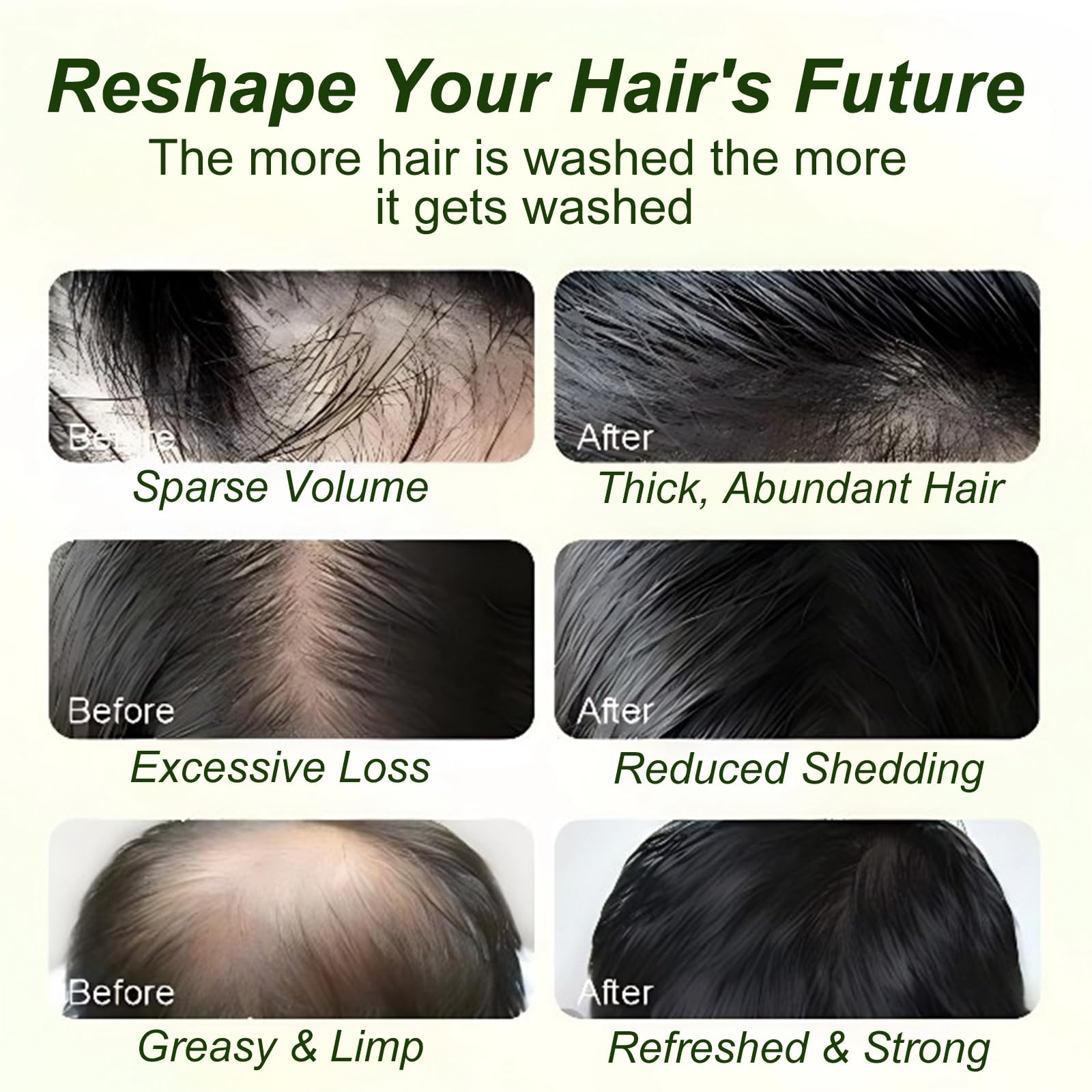 All hair types friendly scalp care on packaging