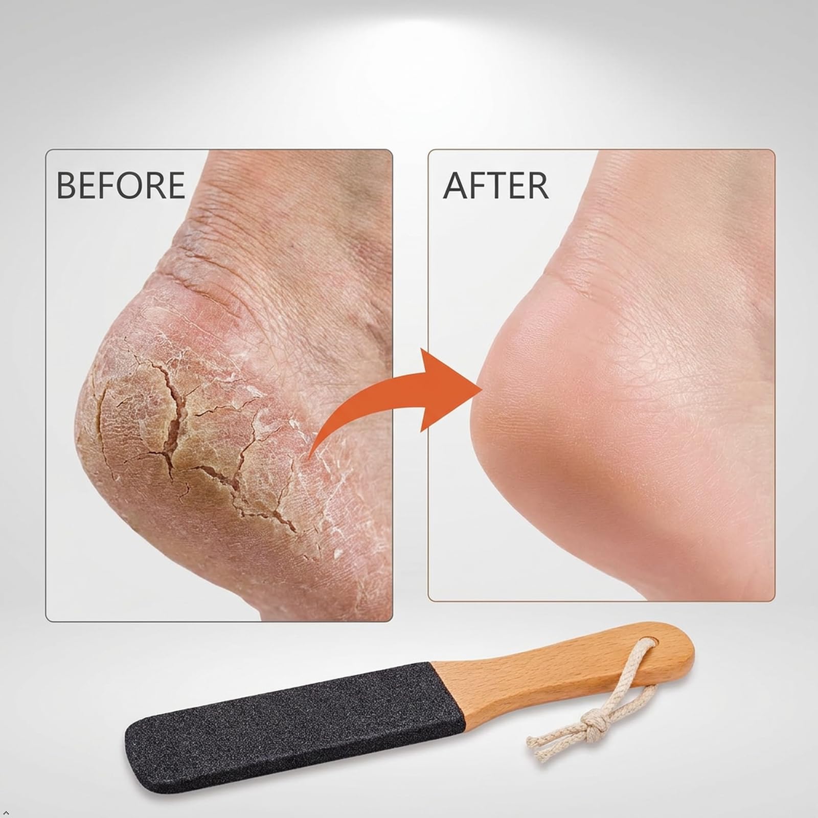 TOPMEET Foot File removes dead skin and calluses