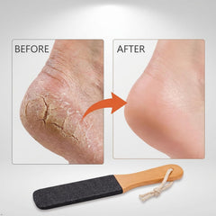 TOPMEET Foot File removes dead skin and calluses