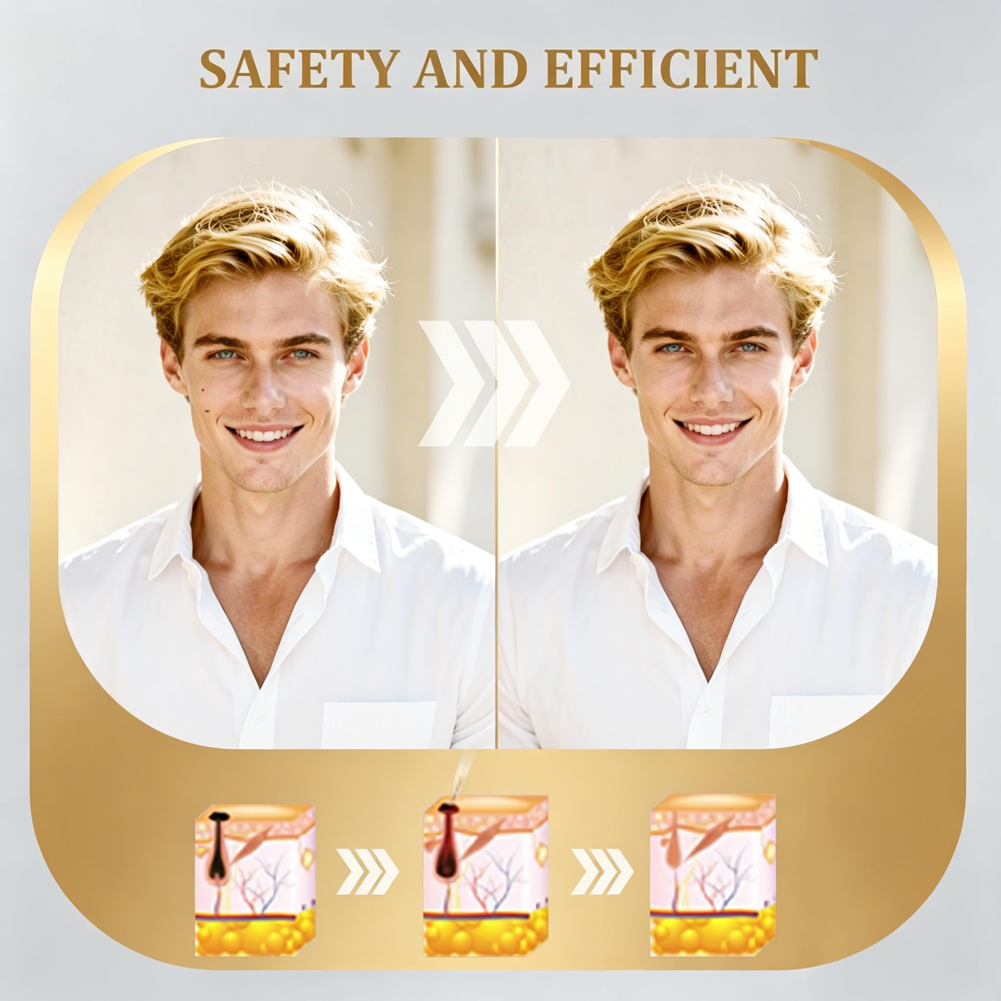 Travel-ready Flyles SkinTag Remover CTS-15