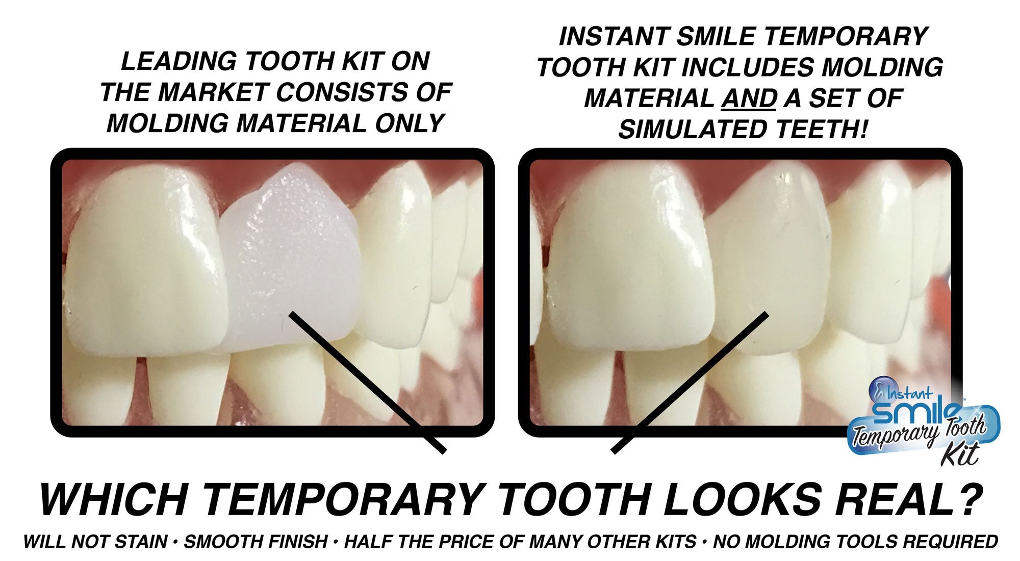 Not a veneer and is designed to temporarily replace one tooth