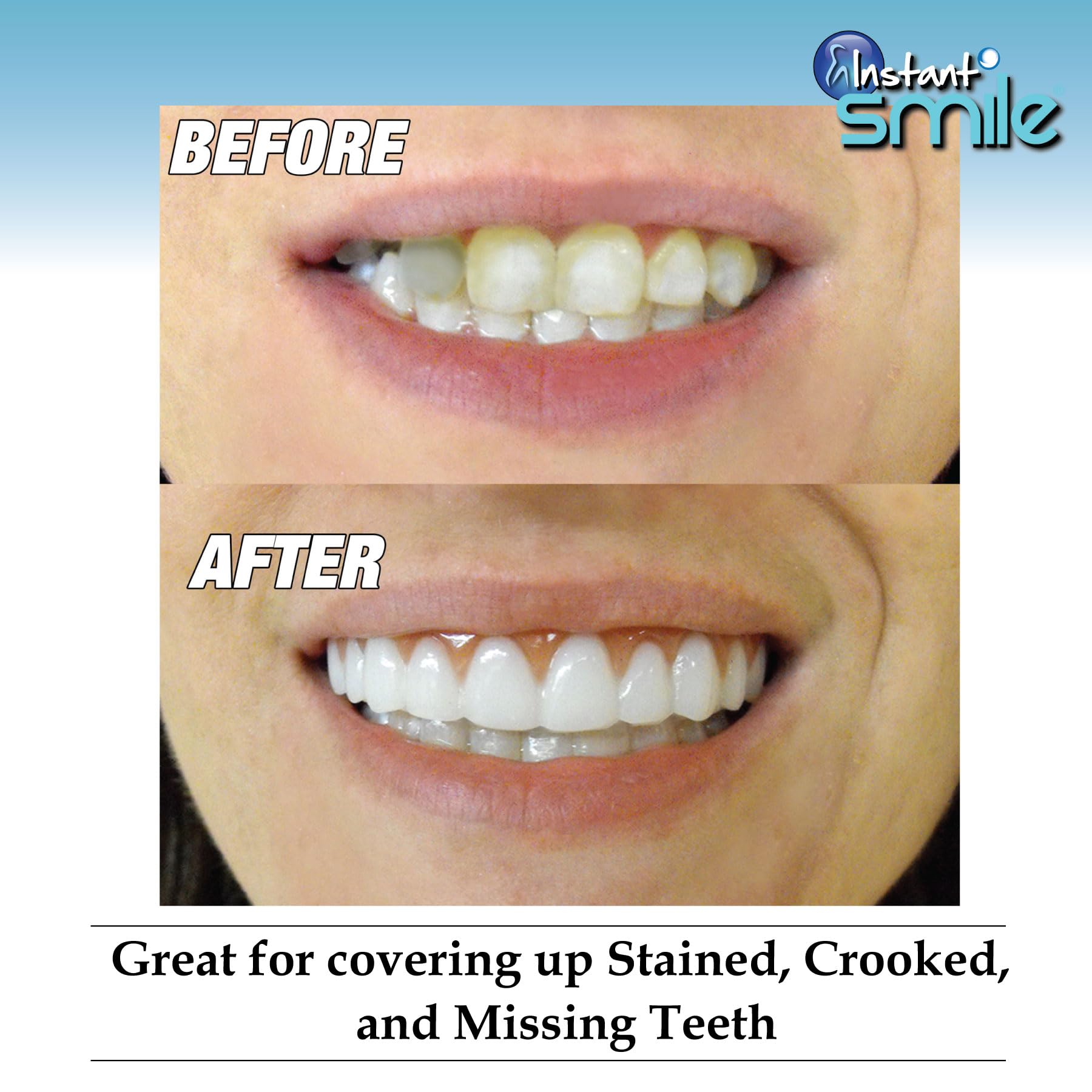 Comfort fit cosmetic teeth wearing at home overview