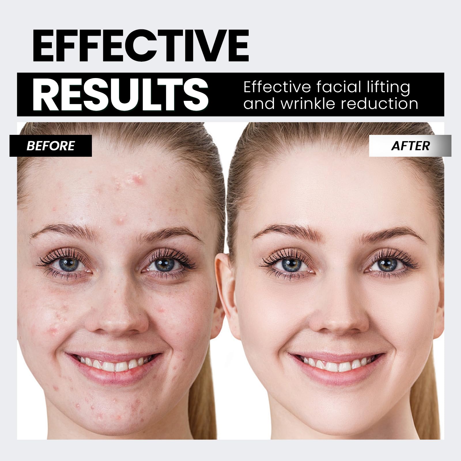 V-shaped face device for contouring and lift