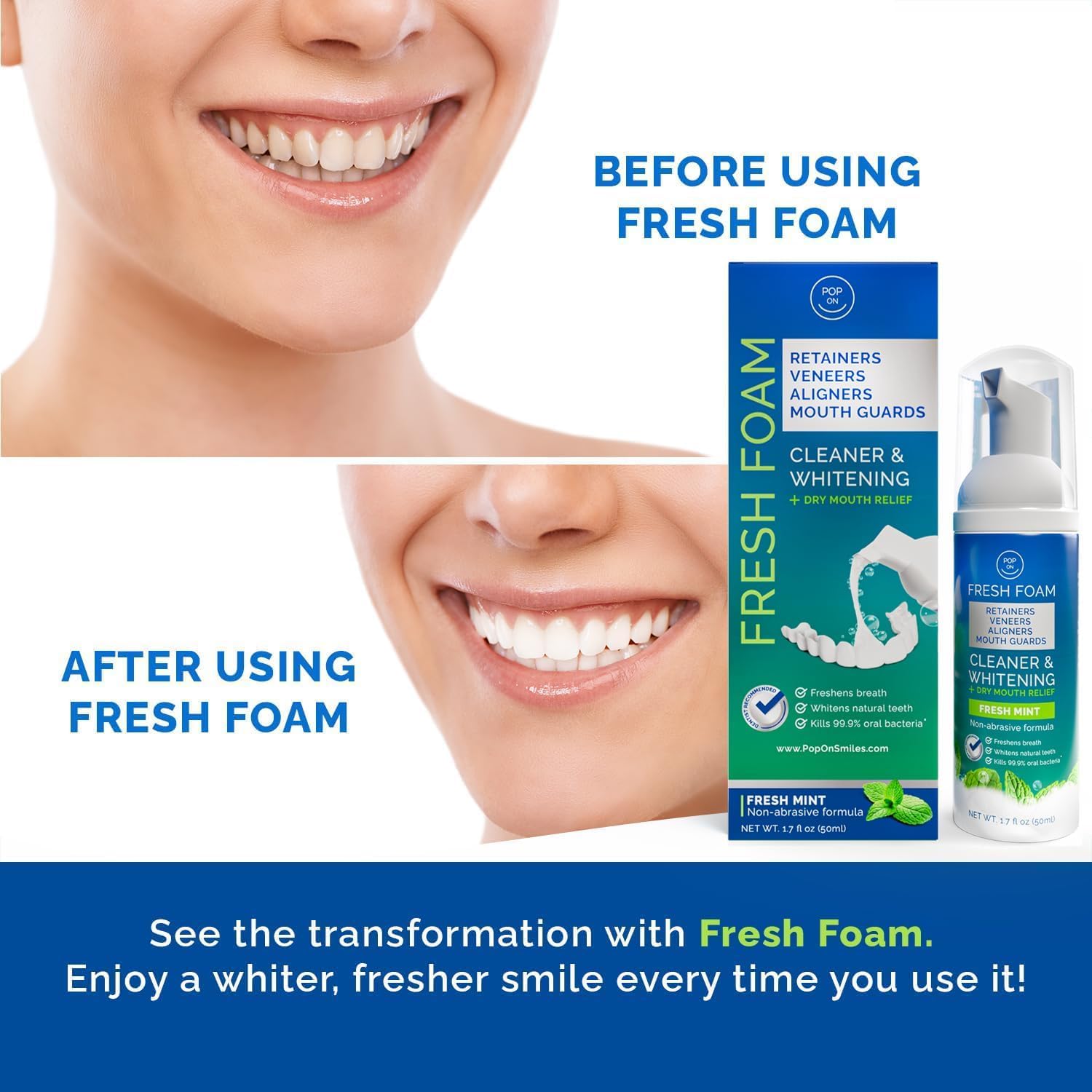 Veneers cleaning foam for removable appliances