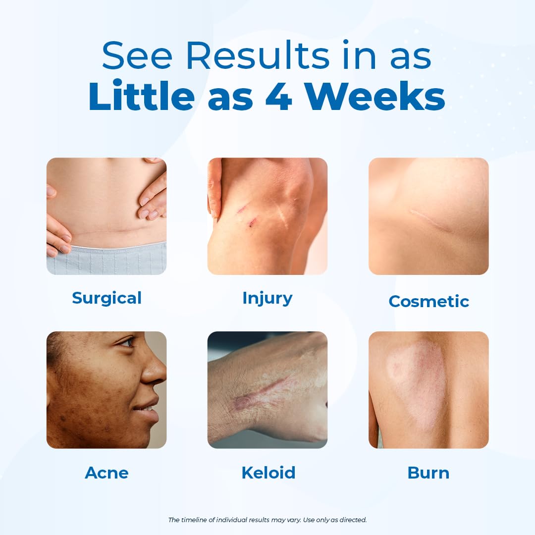 VitaMedica silicone scar gel for new and old scars