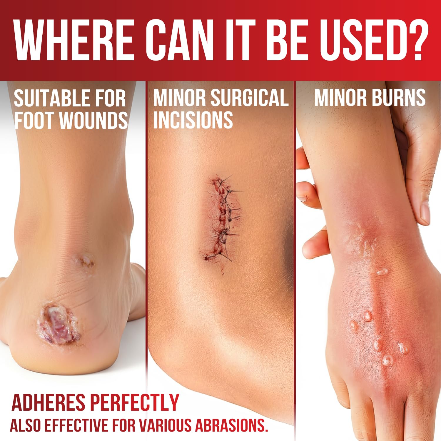 Hypoallergenic medical-grade silicone layer adheres to surrounding skin