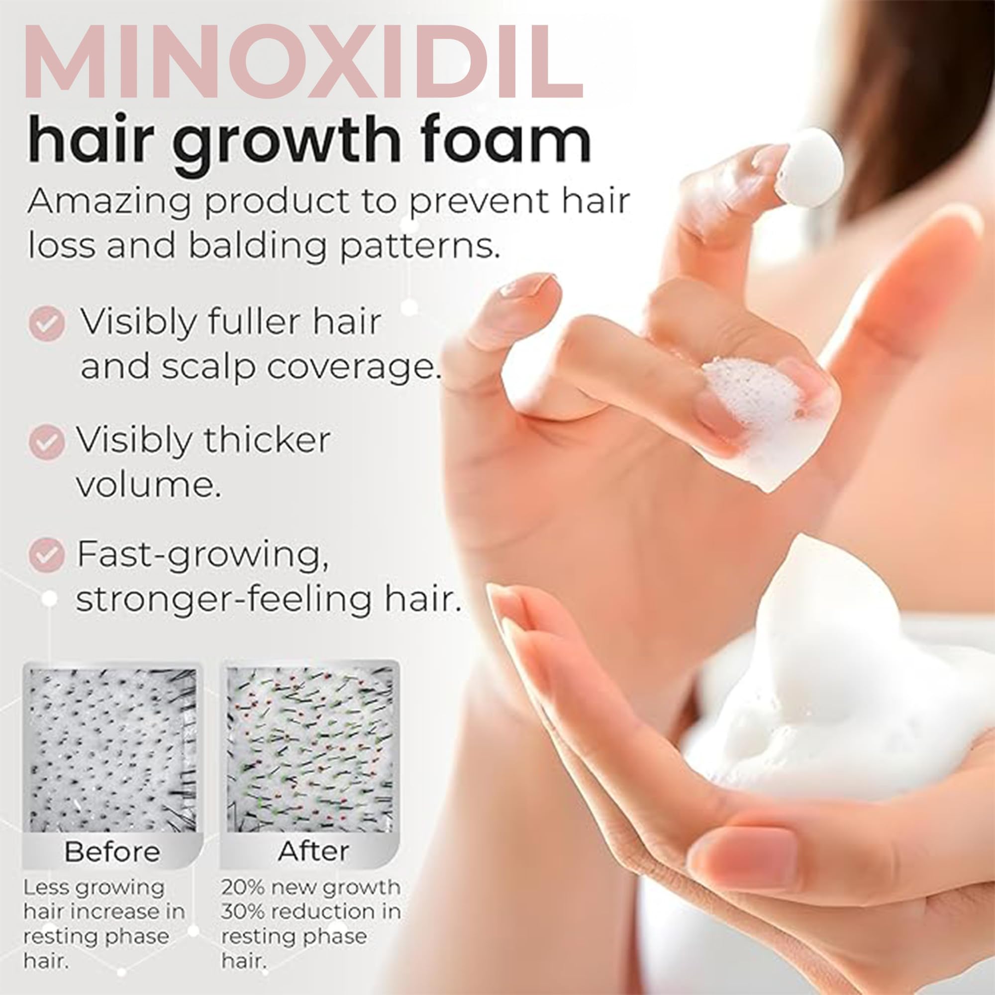 Womens minoxidil topical foam product box