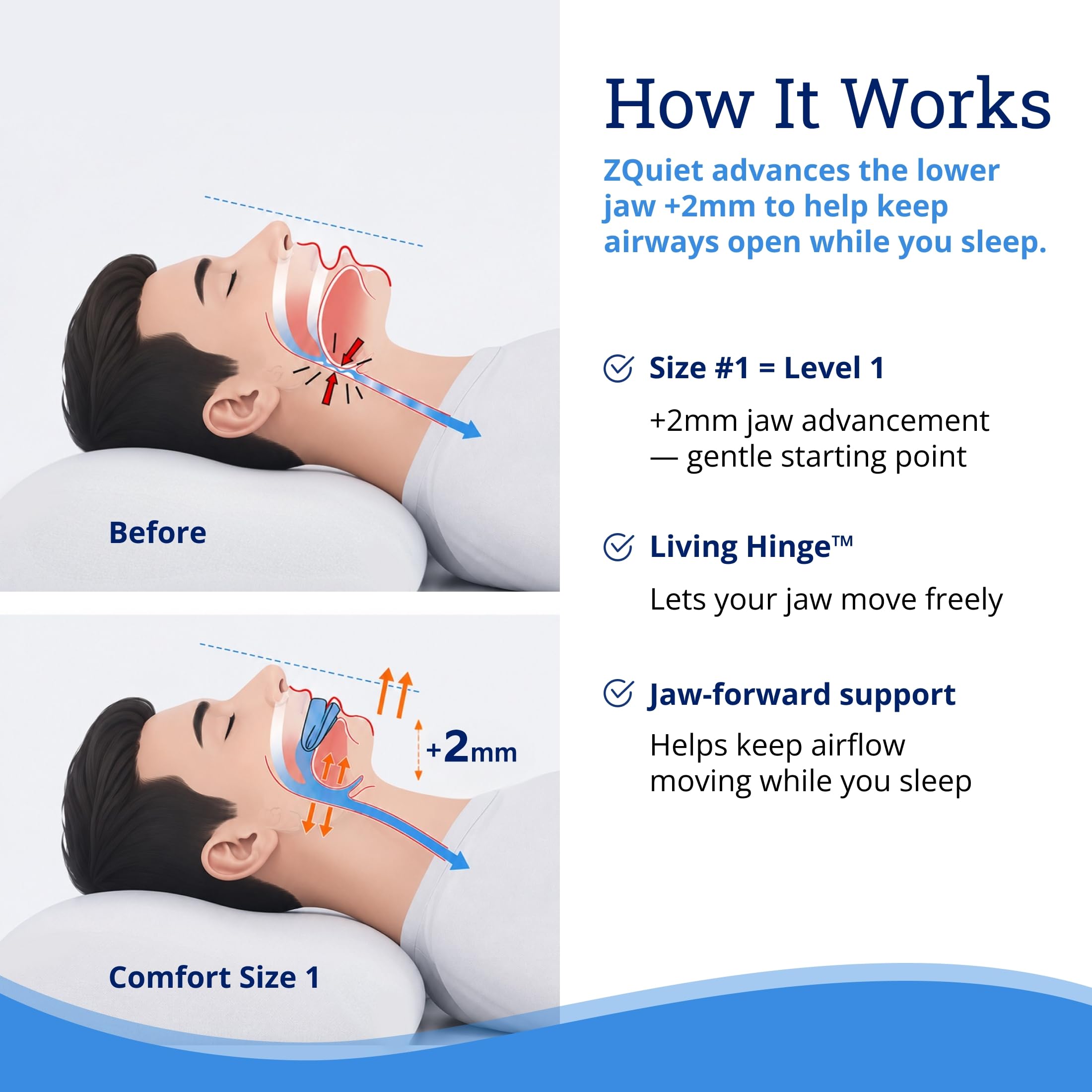 FDA-cleared snoring mouthpiece by ZQuiet