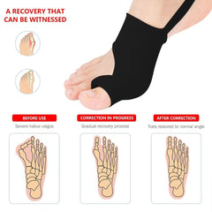 ZXCFBEA bunion splint product image