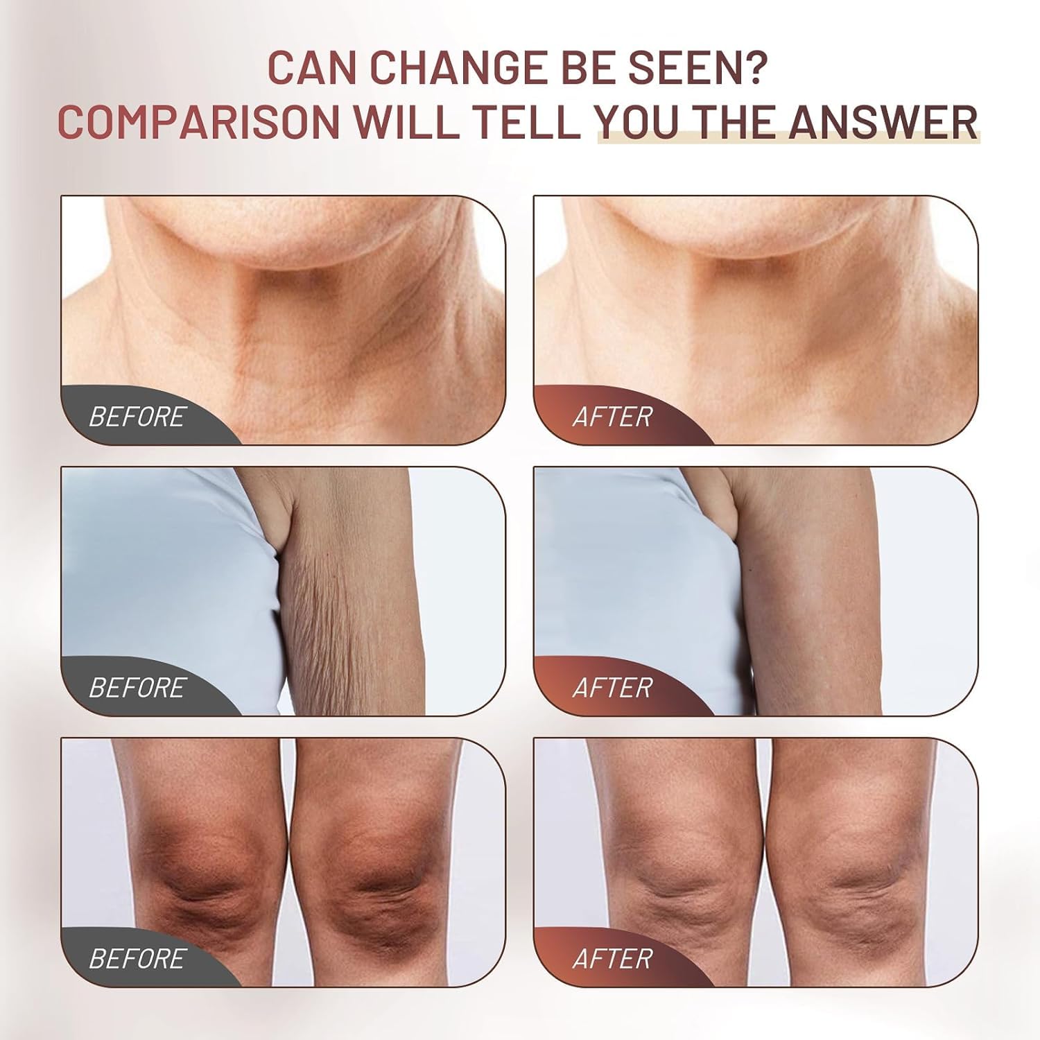 Lightweight non-greasy cream absorbs quickly on skin